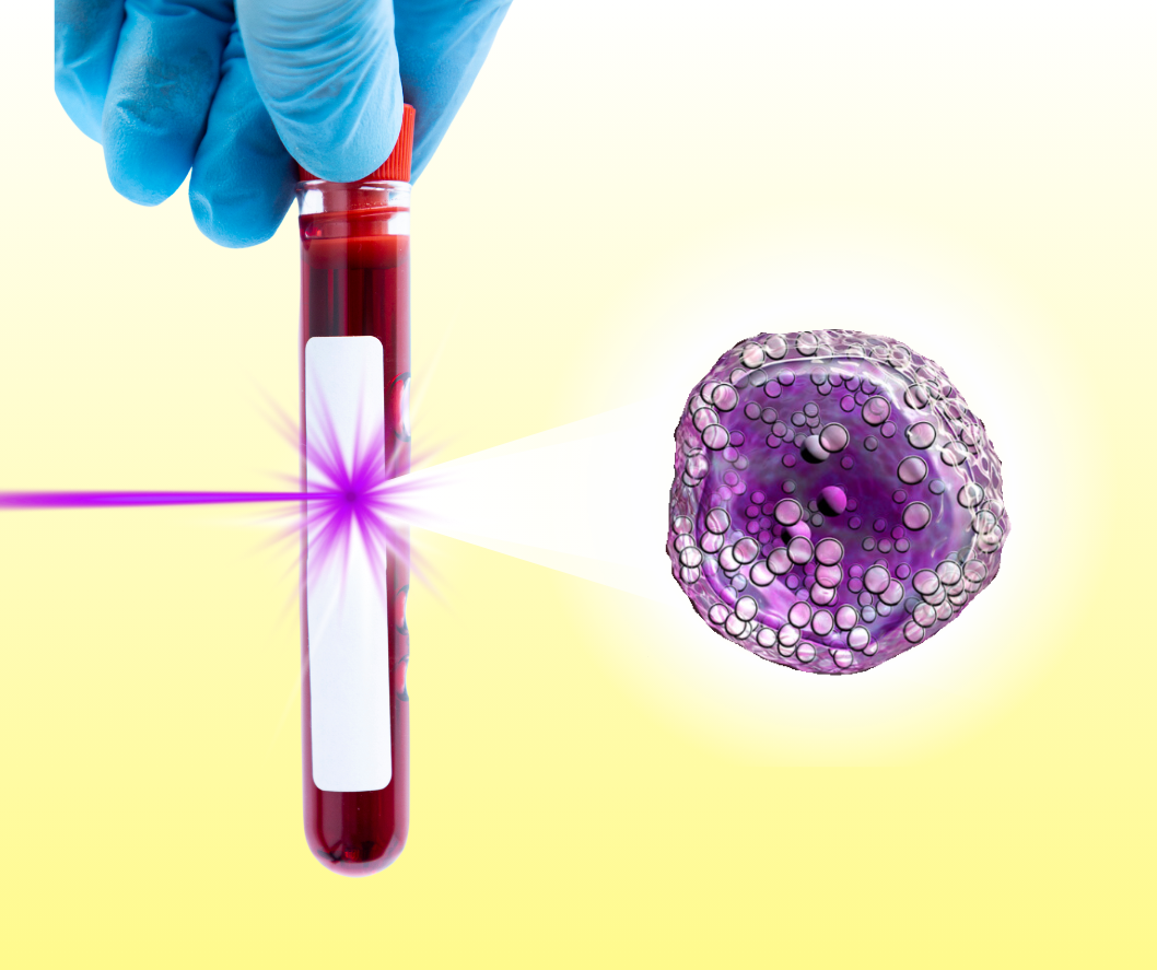 Leveraging Flow Cytometry to Drive Better Patient Outcomes in Hematologic Malignancy Clinical Trials