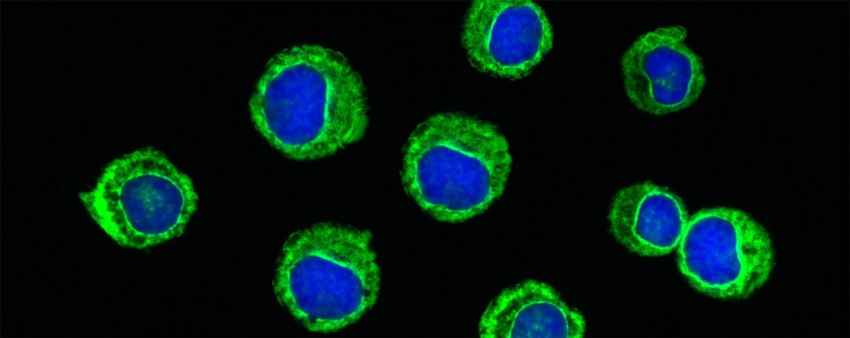 Comparison of Different Fix/Permeabilization Buffers for use in Flow Cytometry Evaluations