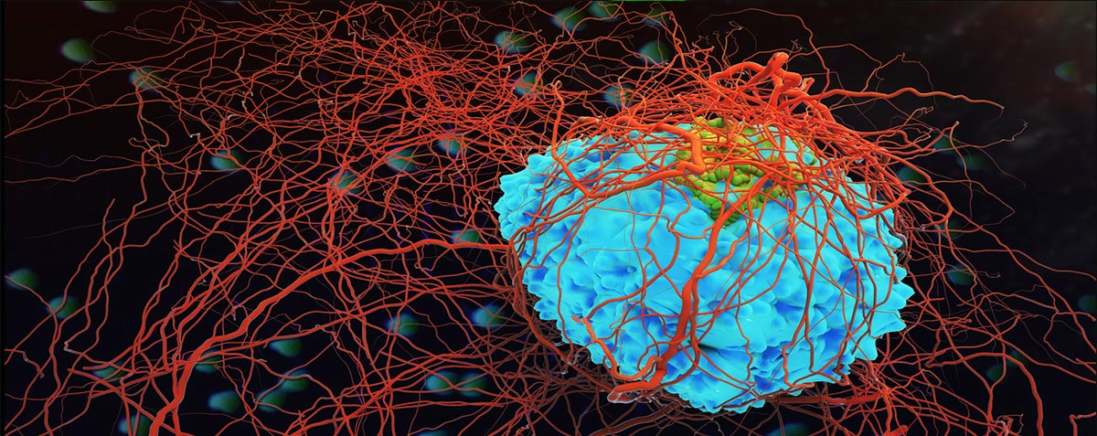 Flow Cytometry Processing and Analysis of Tumor Specimens: Testing Viability and Staining Post Shipping